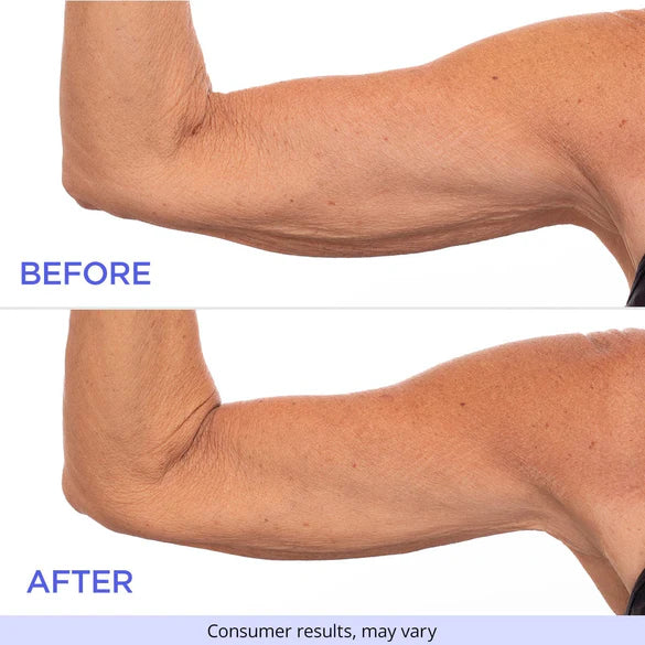 Tone Arm Cream